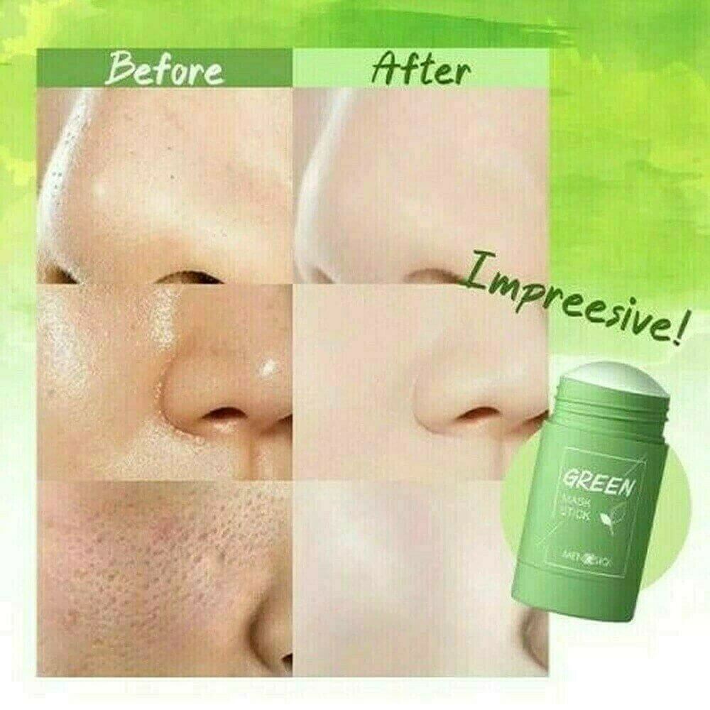 Green Tea Deep Cleanse Mask 🎁 Unique Offer! - Shipping in 24h 🚀